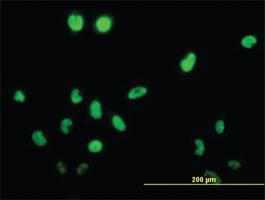 Anti-TSSK1 Mouse Monoclonal Antibody [clone: 2E8]