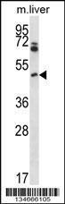 Anti-PIM1 Rabbit Polyclonal Antibody (PE (Phycoerythrin))