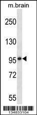 Anti-MARK1 Rabbit Polyclonal Antibody (AP (Alkaline Phosphatase))