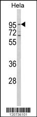 Anti-TFRC Rabbit Polyclonal Antibody