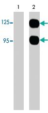 Anti-SEMA3A Rabbit Polyclonal Antibody