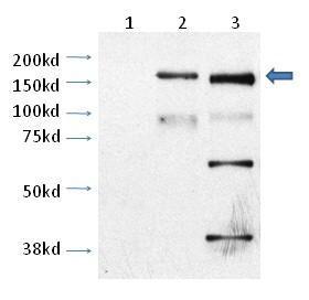 Anti-TRPM2 Rabbit Polyclonal Antibody