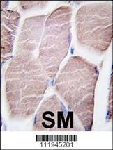 Anti-Glycogen Phosphorylase, Muscle Form Rabbit Polyclonal Antibody (HRP (Horseradish Peroxidase))