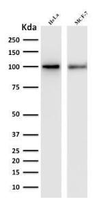 Western blot analysis of human HeLa and MCF-7 cell lysates using Anti-ENAH Antibody [ENAH/1988]