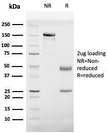 SDS-PAGE analysis of Anti-Prohibitin Antibody [PHB/3229] under non-reduced and reduced conditions; showing intact IgG and intact heavy and light chains, respectively. SDS-PAGE analysis confirms the integrity and purity of the Antibody