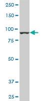 Anti-AMPD2 Mouse Monoclonal Antibody [clone: 2F5]