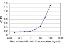 Anti-TSSK1 Mouse Monoclonal Antibody [clone: 2E8]