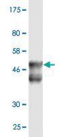 Anti-DNAJB6 Mouse Monoclonal Antibody [clone: 2D12-B9]