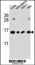 Anti-H2AFJ Rabbit Polyclonal Antibody (APC (Allophycocyanin))