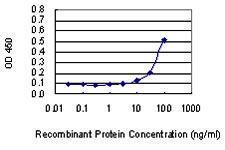 Anti-ARMC6 Mouse Monoclonal Antibody [clone: 2H8]