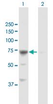 Anti-GBE1 Rabbit Polyclonal Antibody