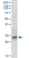 Anti-RRAS2 Mouse Monoclonal Antibody [clone: 2D3-4B8]