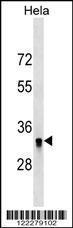 Anti-HIBADH Rabbit Polyclonal Antibody