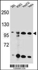 Anti-KSR2 Rabbit Polyclonal Antibody