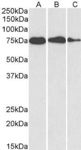 Anti-HSPA5 Antibody (A85241) (0.1 µg/ml) staining of HepG2 (A), HeLa (B) and MCF7 (C) cell lysate (35 µg protein in RIPA buffer). Detected by chemilu minescence