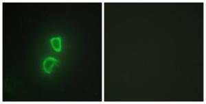 Immunofluorescence analysis of HepG2 cells using Anti-TNFSF11 Antibody. The right hand panel represents a negative control, where the antibody was pre-incubated with the immunising peptide