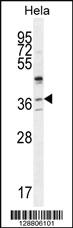 Anti-SELV Rabbit Polyclonal Antibody [clone: 201CT8.2.3]