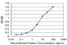 Anti-MSI1 Mouse Monoclonal Antibody [clone: 1B11]