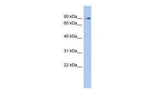 Anti-ZNF711 Rabbit Polyclonal Antibody