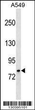 Anti-GLB1 Rabbit Polyclonal Antibody