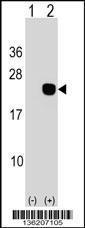 Anti-DCTD Rabbit Polyclonal Antibody