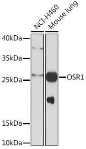 Western blot analysis of extracts of various cell lines, using Anti-OSR1 Antibody (A93285) at 1:1,000 dilution