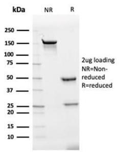 Antibody anti-IL-7 IL74012 BSA 100 µg