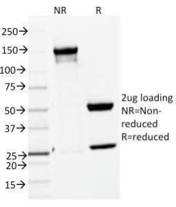 SDS-PAGE analysis of Anti-ENAH Antibody [ENAH/1988] under non-reduced and reduced conditions; showing intact IgG and intact heavy and light chains, respectively SDS-PAGE analysis confirms the integrity and purity of the antibody