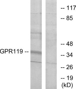 Western blot analysis of lysates from K562 cells using Anti-GPR119 Antibody. The right hand lane represents a negative control, where the antibody is blocked by the immunising peptide