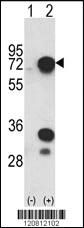 Anti-HNRNPL Rabbit Polyclonal Antibody