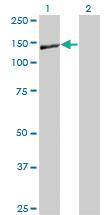 Anti-NID1 Mouse Monoclonal Antibody [clone: 1G3]