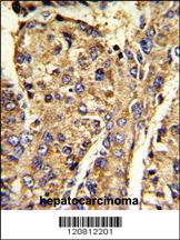 Anti-HNRNPL Rabbit Polyclonal Antibody