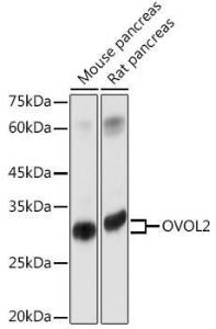 Western blot analysis of extracts of various cell lines, using Anti-OVOL2 Antibody (A93286) at 1:1,000 dilution. The secondary antibody was Goat Anti-Rabbit IgG H&L Antibody (HRP) at 1:10,000 dilution.