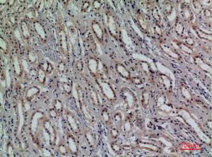 Immunohistochemical analysis of paraffin-embedded human kidney using Anti-KLRC1 + KLRC2 + KLRC3 Antibody