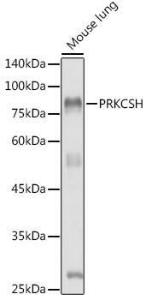 Western blot analysis of extracts of Mouse lung, using Anti-Glucosidase 2 subunit beta Antibody (A9360) at 1:1,000 dilution