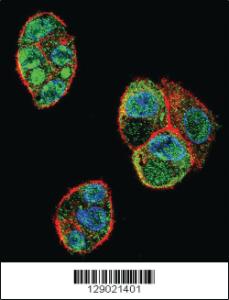 Anti-C11ORF95 Rabbit Polyclonal Antibody [clone: 205CT18.3.1]