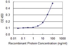 Anti-NID1 Mouse Monoclonal Antibody [clone: 1G3]