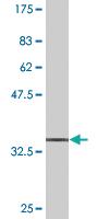 Anti-DNAJB6 Mouse Monoclonal Antibody [clone: 1A5]