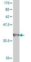 Anti-IGSF21 Mouse Polyclonal Antibody