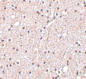 Anti-BRSK2 Rabbit Polyclonal Antibody