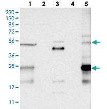 Anti-PPP1R42 Rabbit Polyclonal Antibody