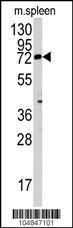 Anti-MGAT3 Rabbit Polyclonal Antibody (FITC (Fluorescein))