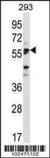 Anti-SIGLEC6 Rabbit Polyclonal Antibody (FITC (Fluorescein))