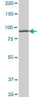 Anti-AMPD2 Mouse Monoclonal Antibody [clone: 2F5]