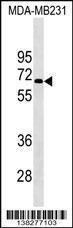 Anti-KCNF1 Rabbit Polyclonal Antibody (HRP (Horseradish Peroxidase))