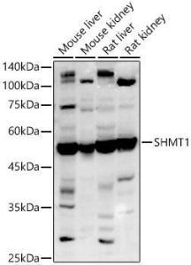 Western blot analysis of extracts of various cell lines, using Anti-SHMT1 Antibody (A9381) at 1:1,000 dilution