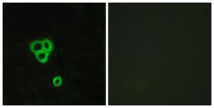 Immunofluorescence analysis of MCF7 cells using Anti-GPR119 Antibody. The right hand panel represents a negative control, where the antibody was pre-incubated with the immunising peptide