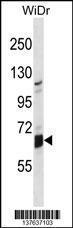 Anti-GLB1L Rabbit Polyclonal Antibody