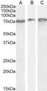 Anti-HSPA5 antibody