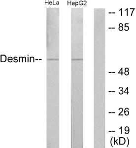 Western blot analysis of lysates from HeLa and HepG2 cells using Anti-Desmin Antibody. The right hand lane represents a negative control, where the antibody is blocked by the immunising peptide